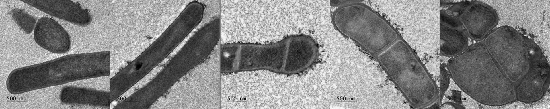 Transmission electron micrographs of Bacillus subtilis cells
