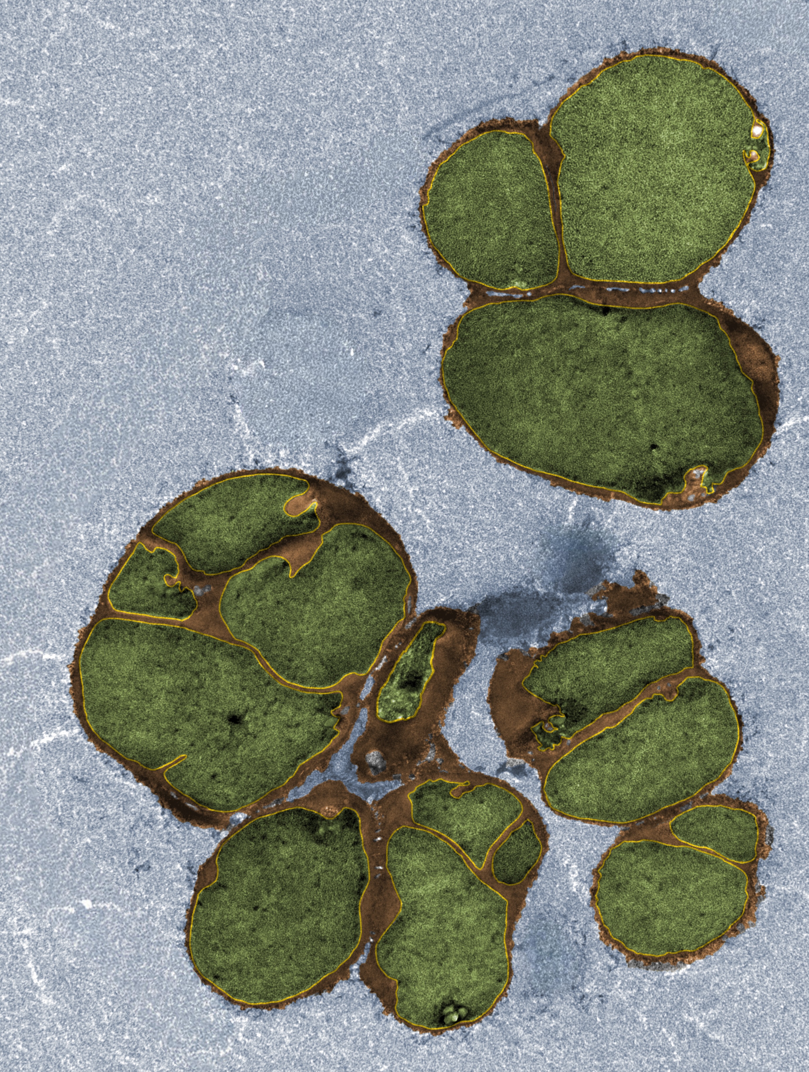 False colored image showing *B. subtilis* cells fully depleted for wall teichoic acids and imaged with transmission electron microscopy.